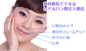 ヒアルロン酸注入